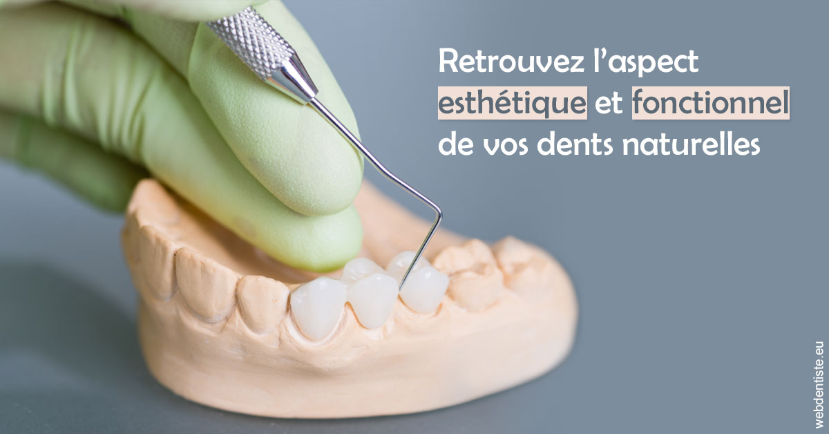 https://dr-chapon-frederic.chirurgiens-dentistes.fr/Restaurations dentaires 1