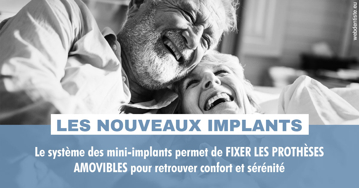 https://dr-chapon-frederic.chirurgiens-dentistes.fr/Les nouveaux implants 2