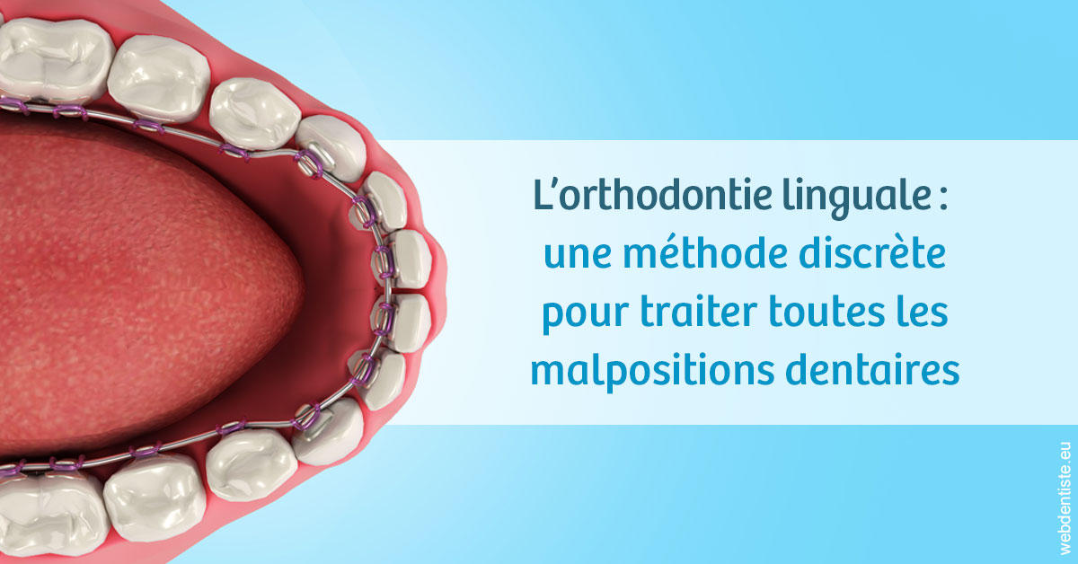 https://dr-chapon-frederic.chirurgiens-dentistes.fr/L'orthodontie linguale 1
