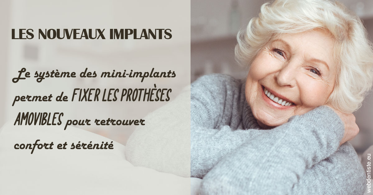 https://dr-chapon-frederic.chirurgiens-dentistes.fr/Les nouveaux implants 1