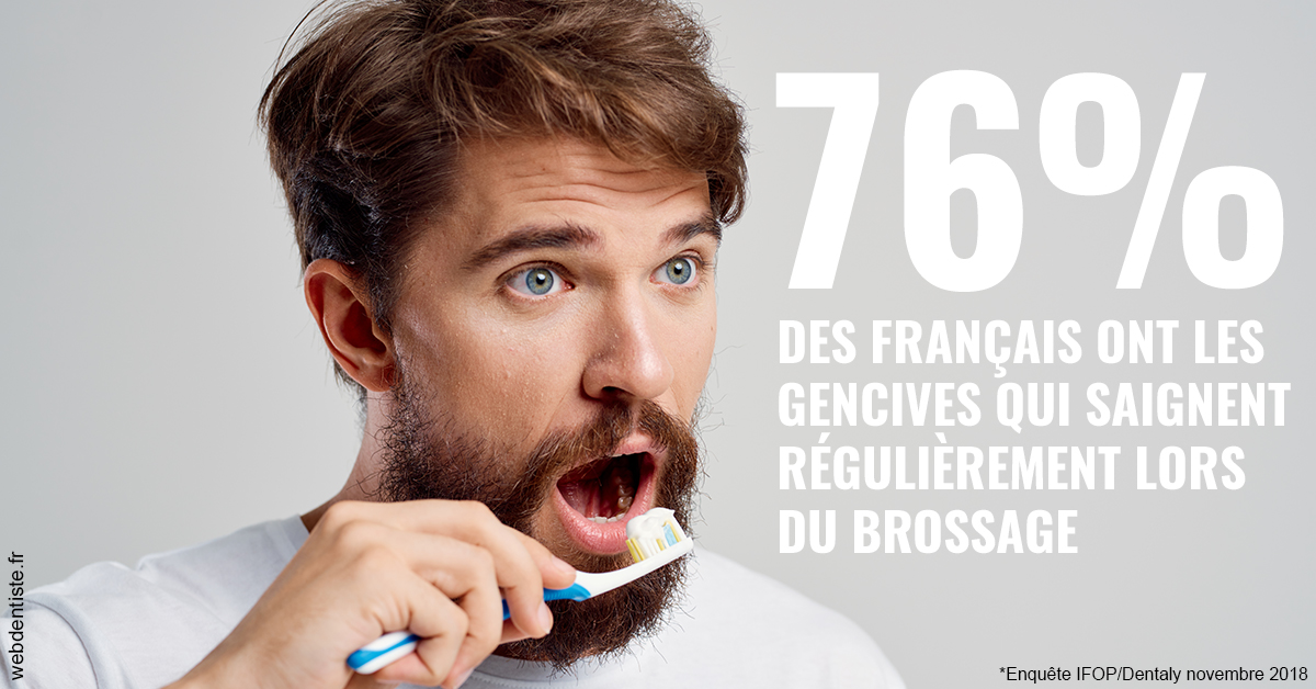 https://dr-chapon-frederic.chirurgiens-dentistes.fr/76% des Français 2