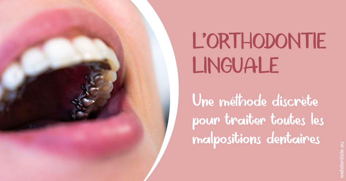 https://dr-chapon-frederic.chirurgiens-dentistes.fr/L'orthodontie linguale 2