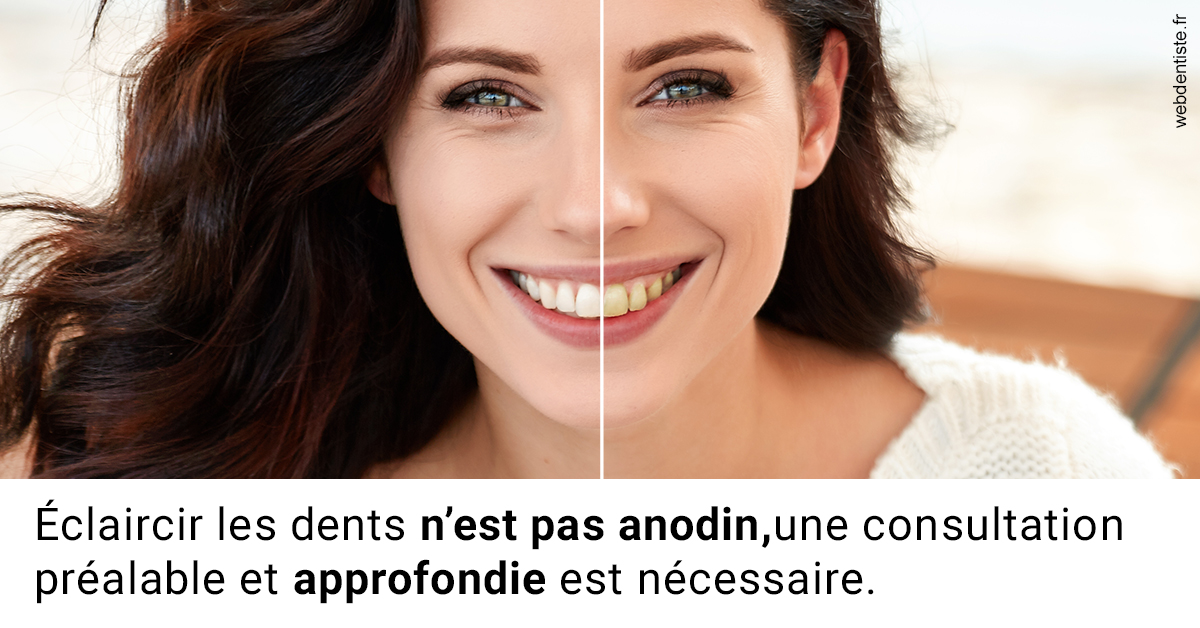 https://dr-chapon-frederic.chirurgiens-dentistes.fr/Le blanchiment 2