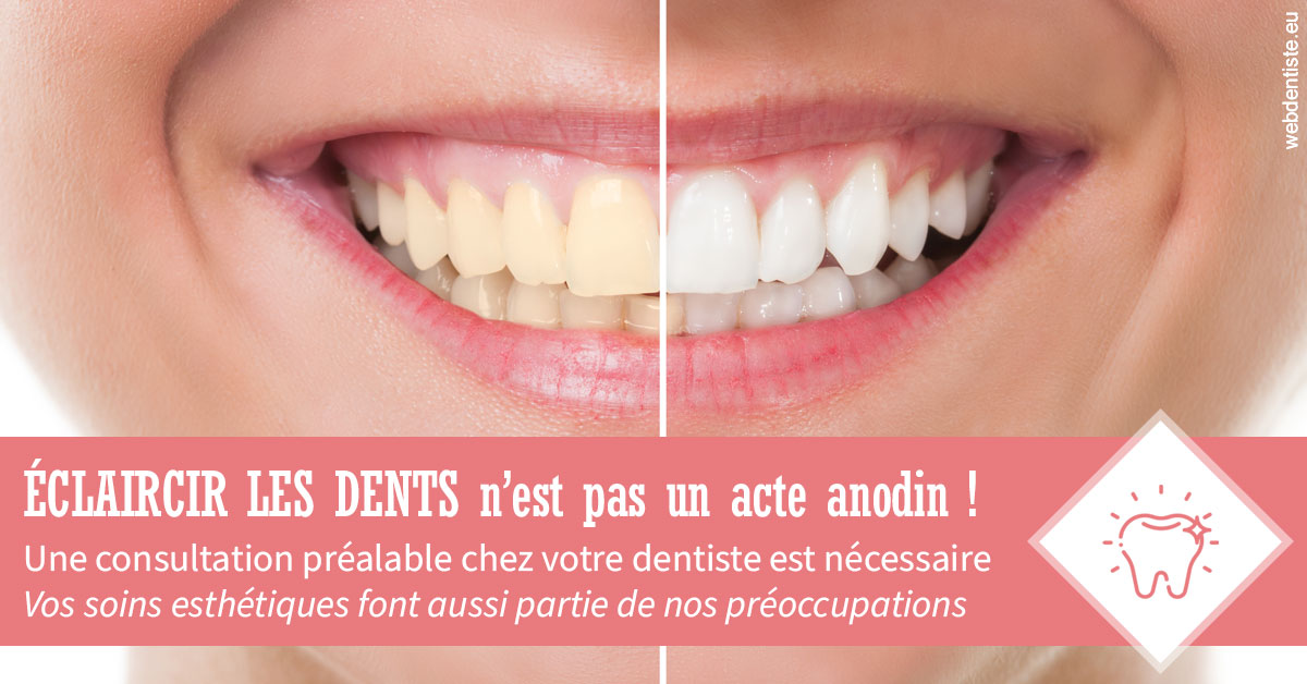 https://dr-chapon-frederic.chirurgiens-dentistes.fr/Eclaircir les dents 1