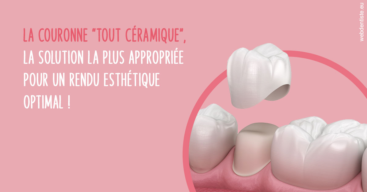 https://dr-chapon-frederic.chirurgiens-dentistes.fr/La couronne "tout céramique"