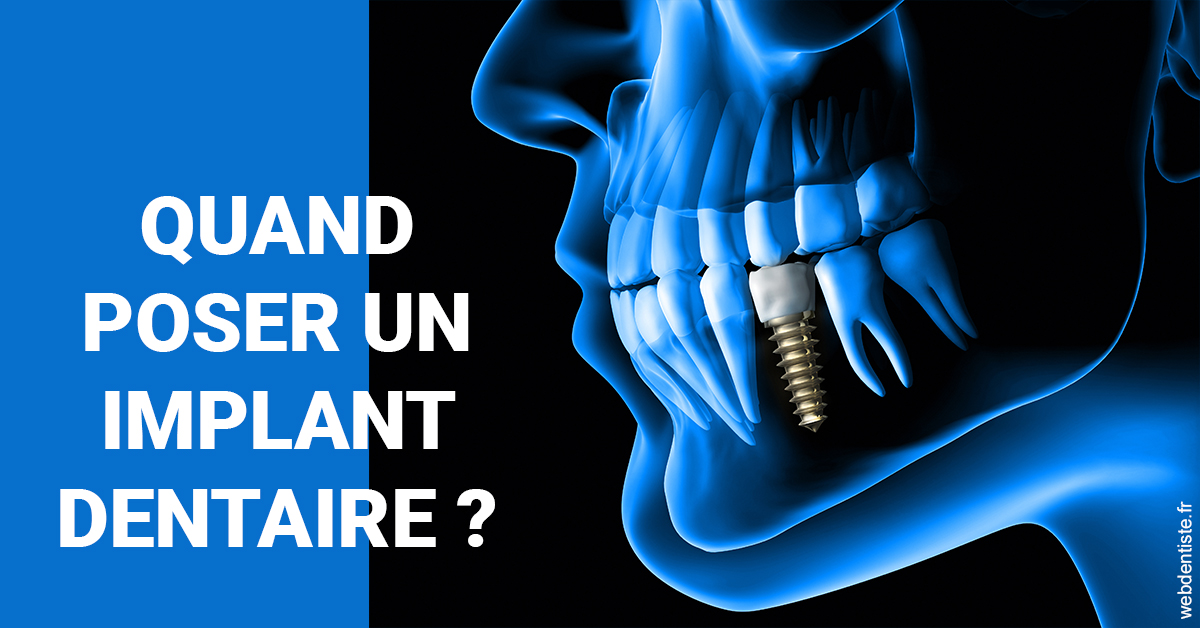 https://dr-chapon-frederic.chirurgiens-dentistes.fr/Les implants 1