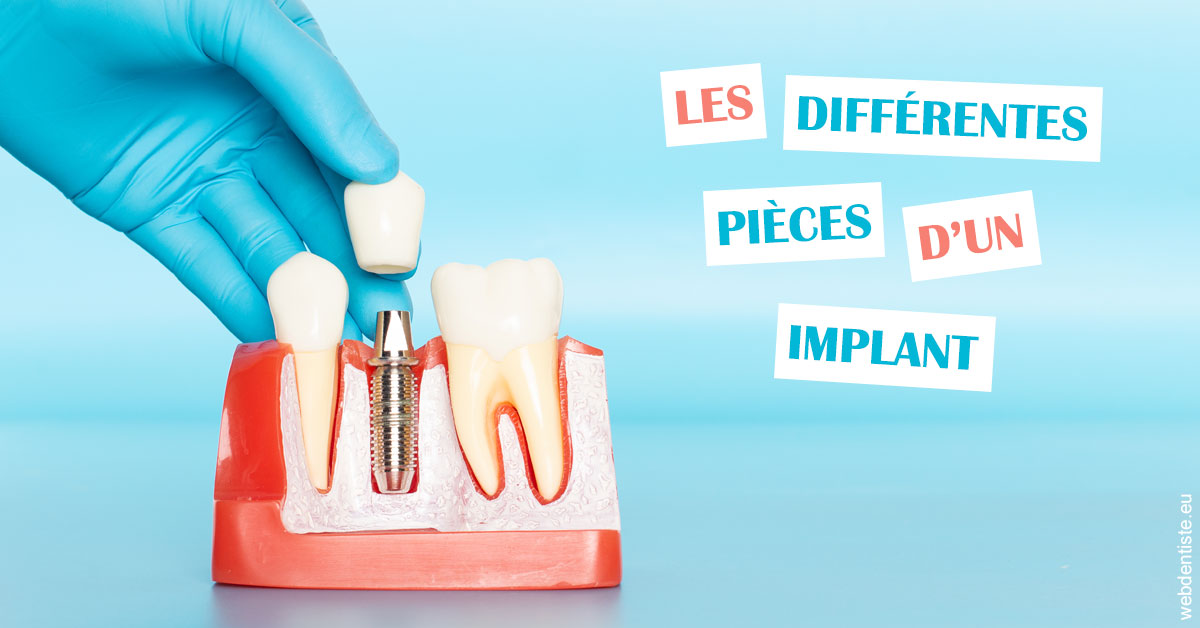 https://dr-chapon-frederic.chirurgiens-dentistes.fr/Les différentes pièces d’un implant 2