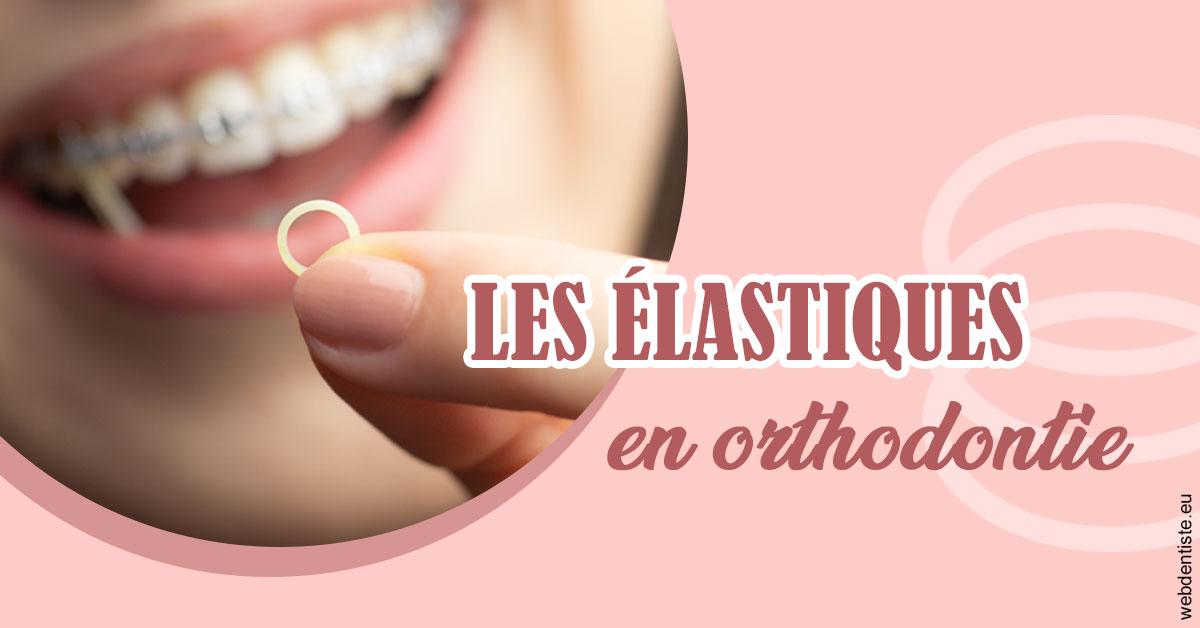 https://dr-chapon-frederic.chirurgiens-dentistes.fr/Elastiques orthodontie 1