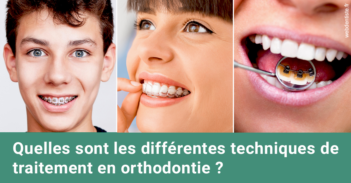https://dr-chapon-frederic.chirurgiens-dentistes.fr/Les différentes techniques de traitement 2