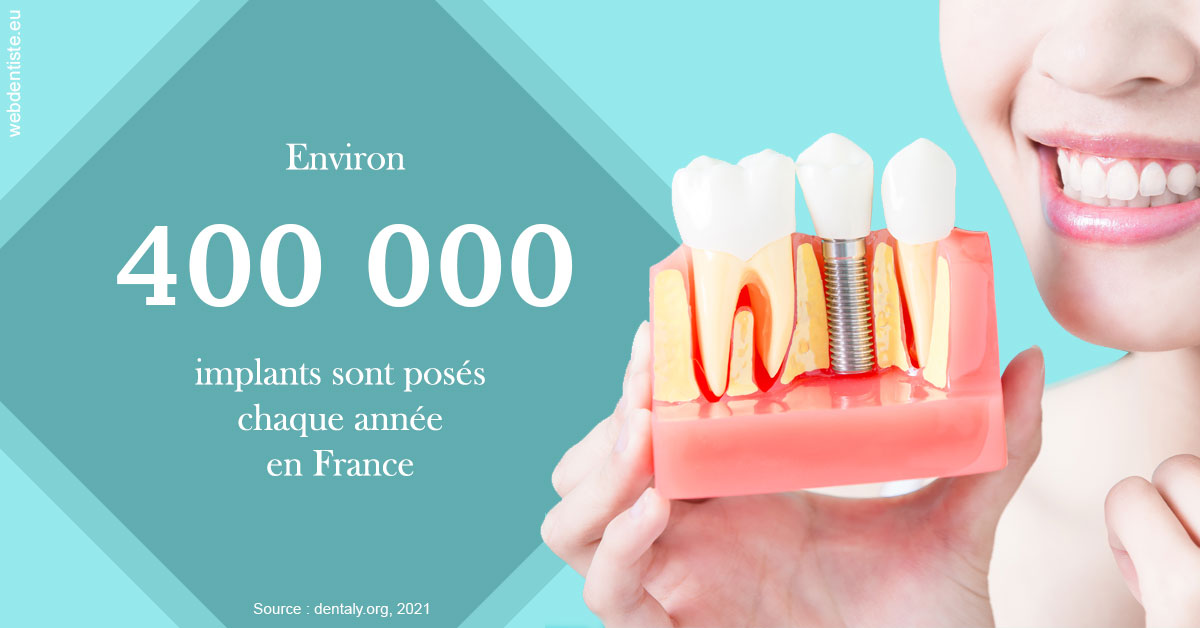 https://dr-chapon-frederic.chirurgiens-dentistes.fr/Pose d'implants en France 2